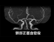 MRI