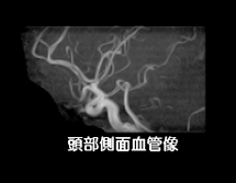 MRI