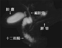 MRI